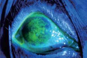 ODoF - Dry Eye & Aesthetics Fluorescein Cobalt Blue