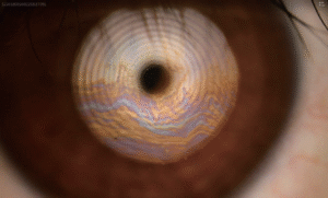 ODoF - Dry Eye & Aesthetics Auto Interferometry (lipid layer)