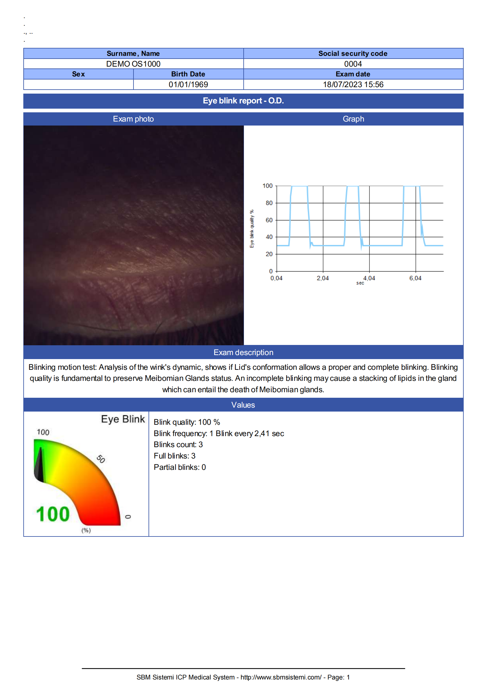 SBM Dry Eye Report_04