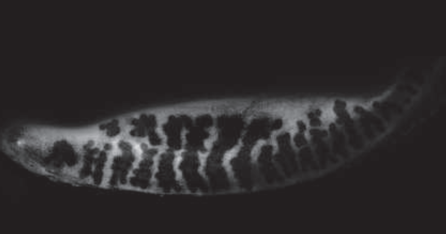 Transillumination