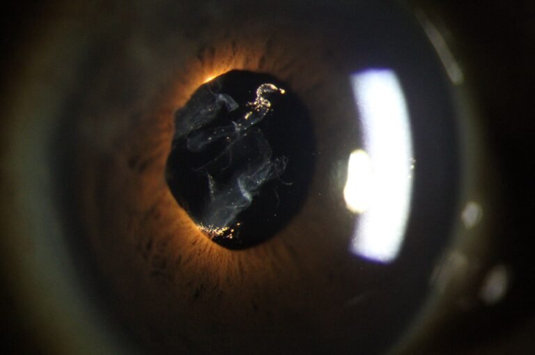 Phalcon Digital Slit Lamp 1