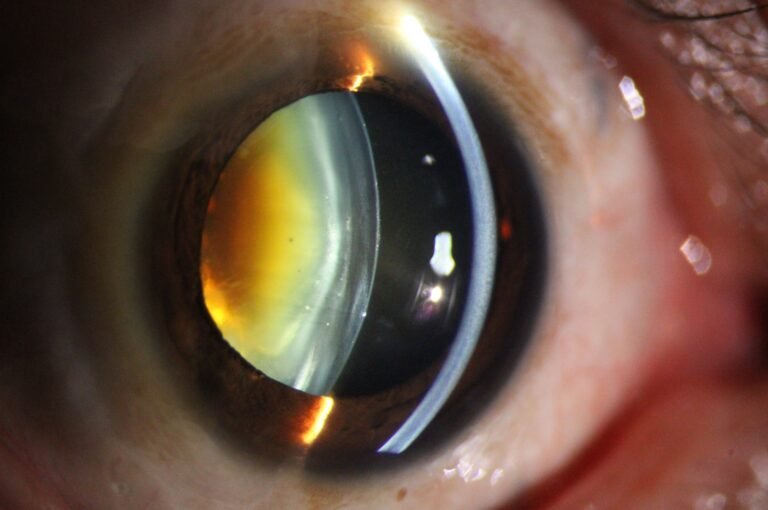 Phalcon Digital Slit Lamp 23