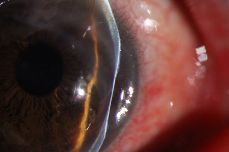 Phalcon Digital Slit Lamp 28